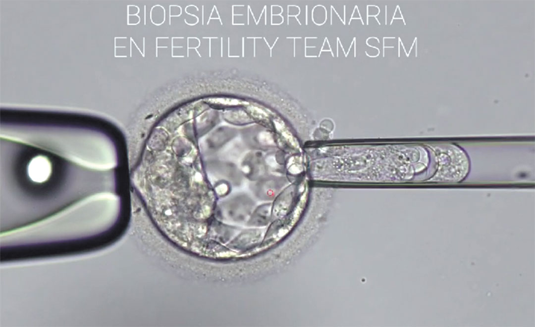 Fertility Team SFM introduce la Biopsia Embrionaria; marca un ...